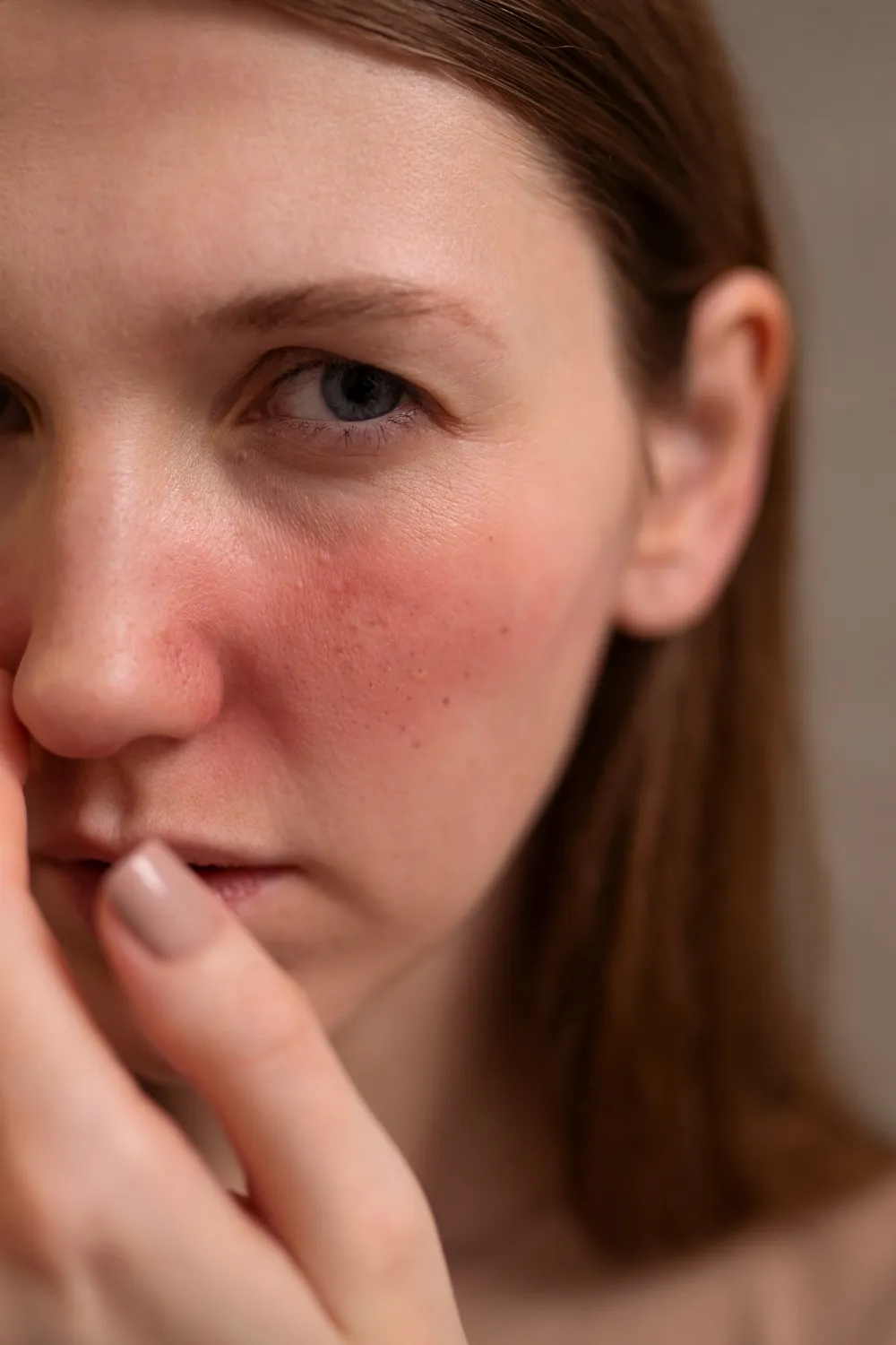 Laser C Toning (Sun Damage)
