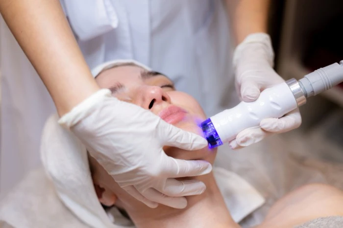 Fractional CO2 Laser