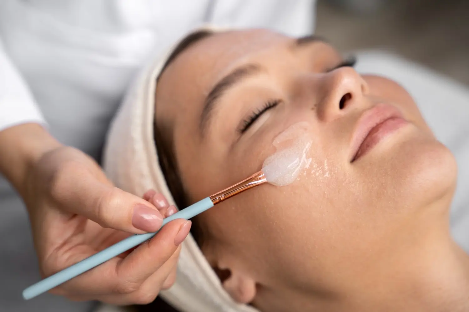 Chemical Peel Treatment