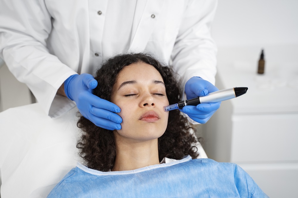 RF Microneedling (Genius)