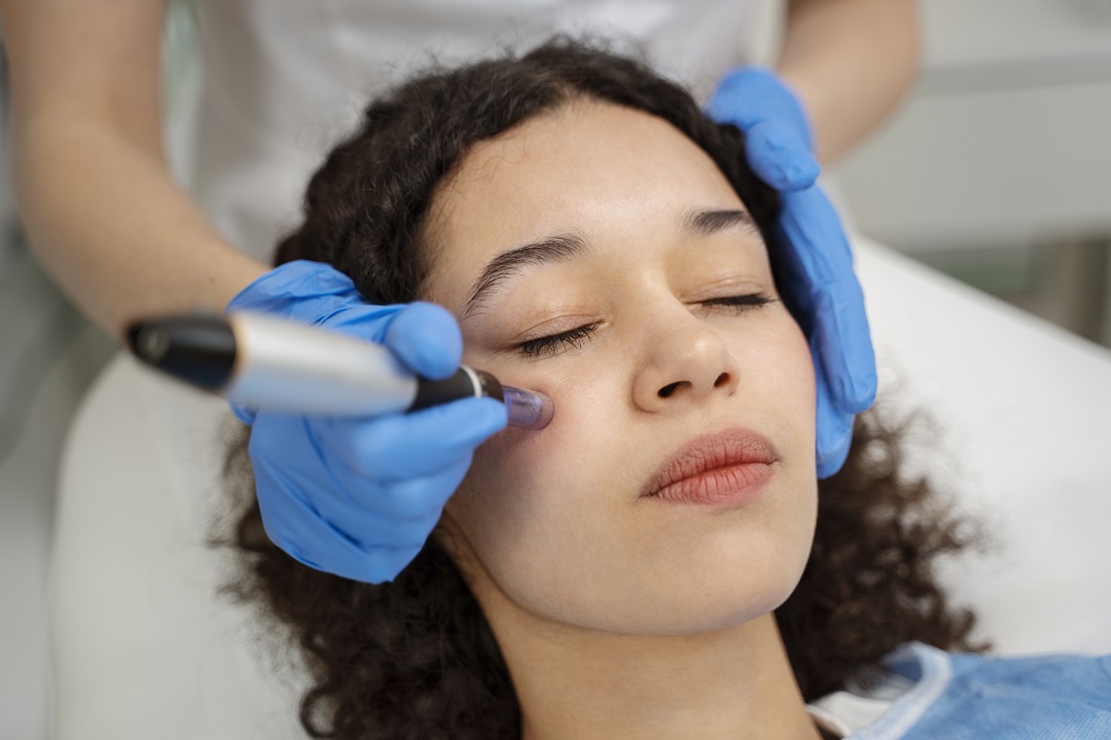 Genius RF Microneedling in Cumming, GA: How It Works & Who It's For