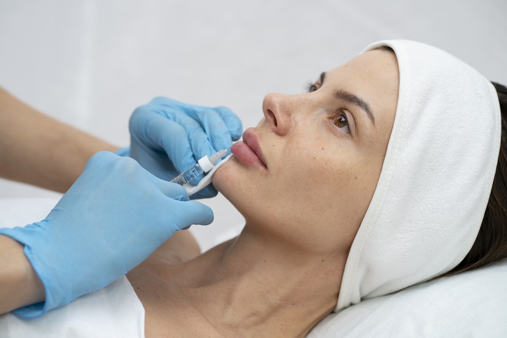 Lip Fillers in Cumming