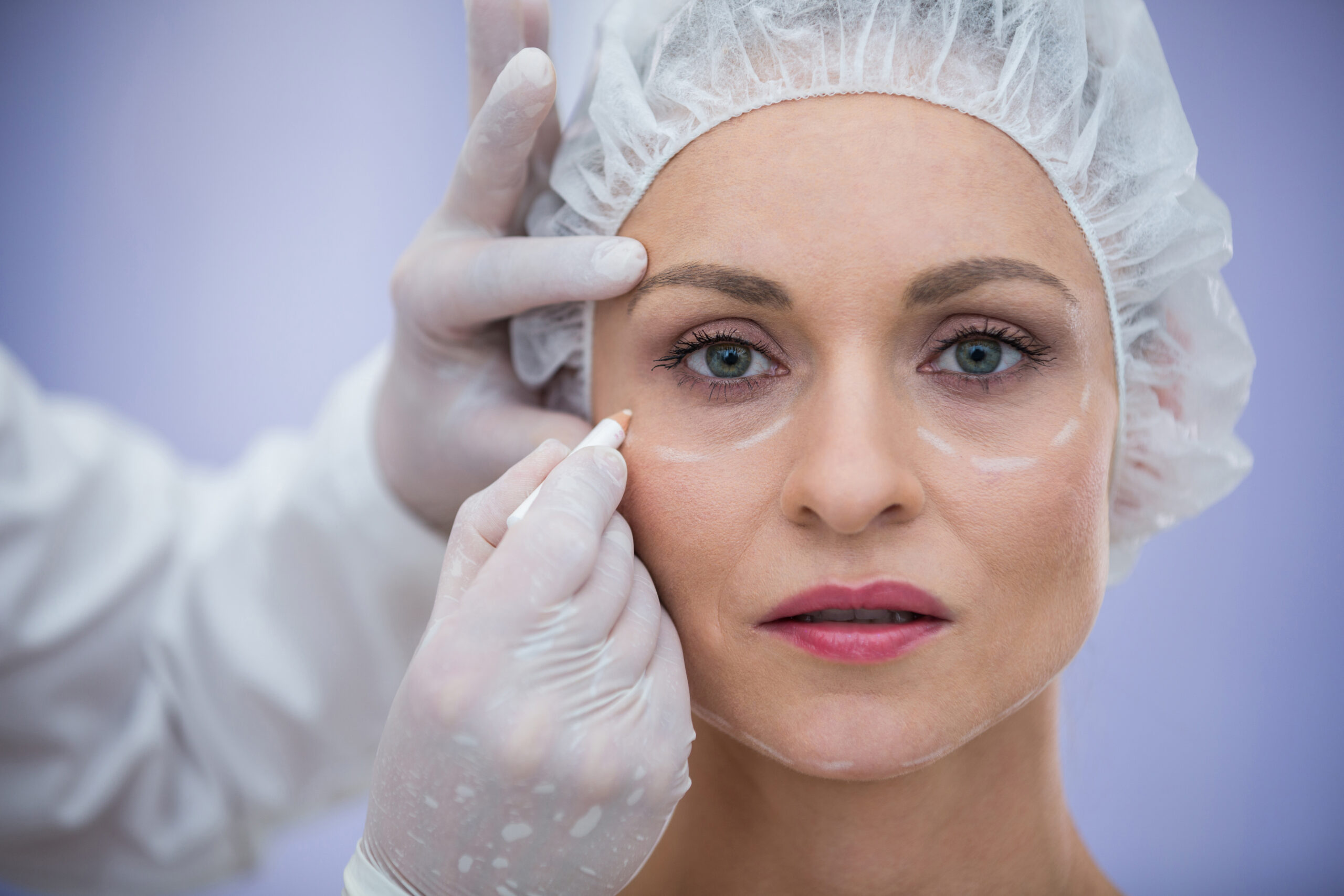 Crow's Feet, Puffy Eyes & Droopy Lids