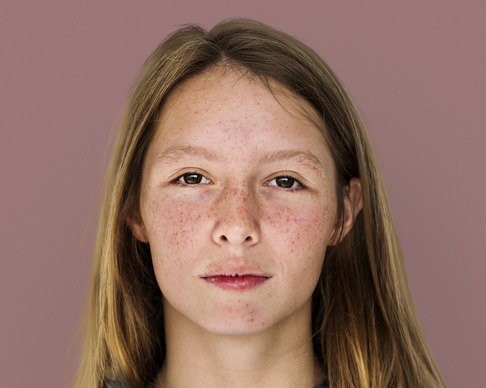 Red, Blotchy & Uneven Skin